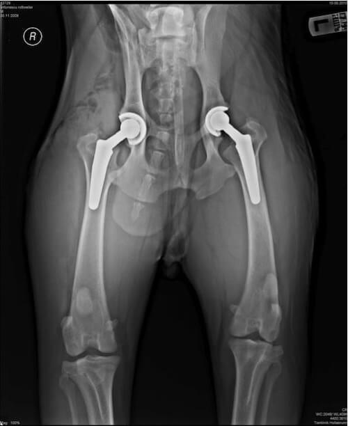 Osteoartrita soldului | Blausen Medical