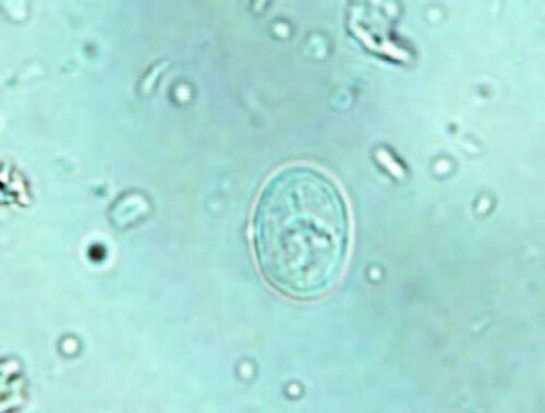 Giardia parazita macska - Cum ne infectam cu giardia?, Giardia caini simptome