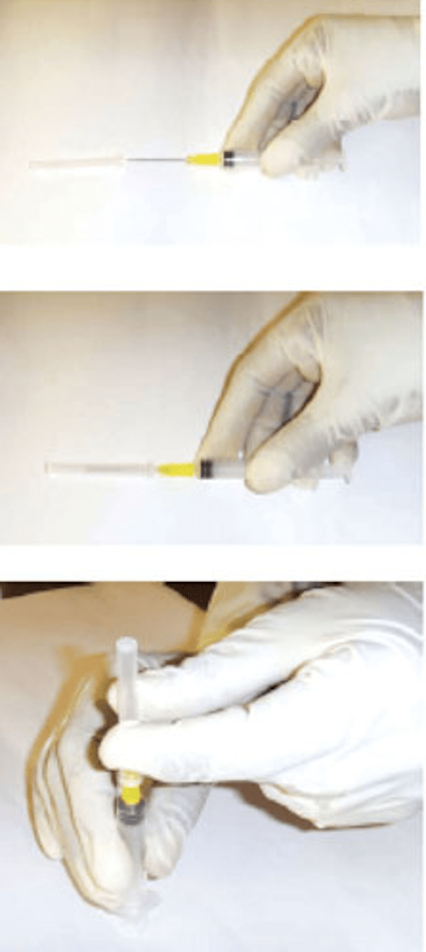 metoda de pus capacul la seringa